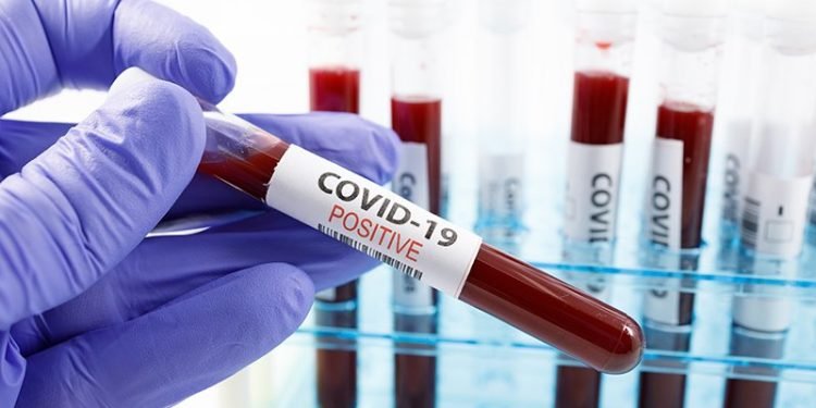 বিচারক ও বিচারালয়ের কর্মচারী মিলিয়ে সাড়ে ৩শ’ জন করোনায় আক্রান্ত